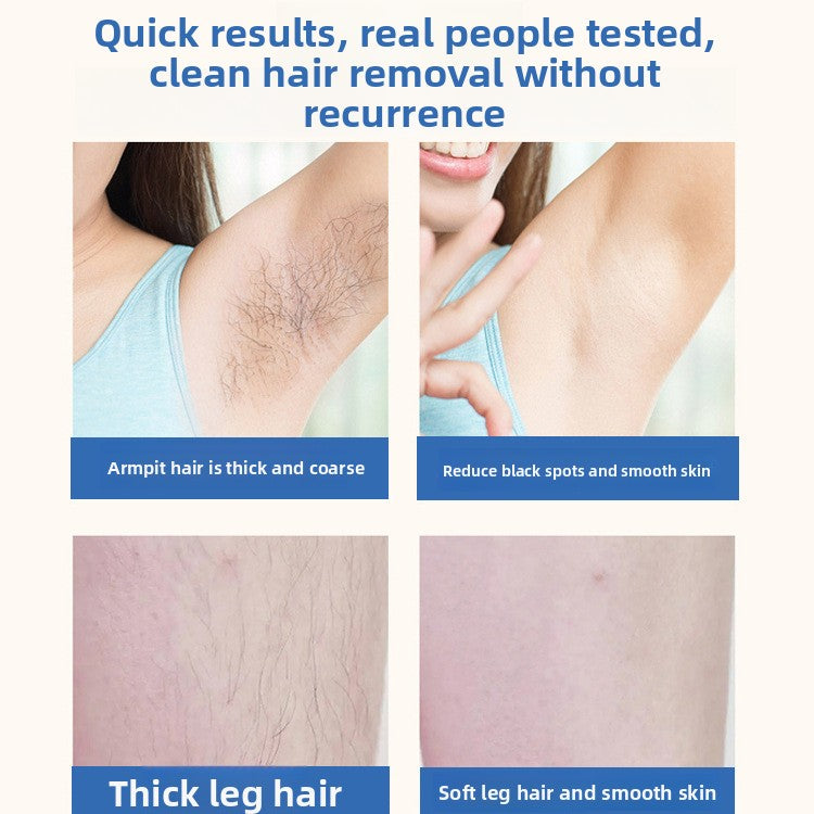 Laser Hair Removal Device for Women